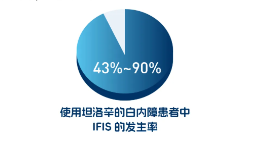 BVI倍锋丨名词科普（虹膜松弛综合征）