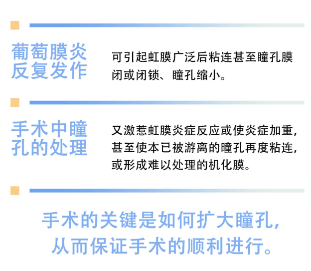 葡萄膜炎并发小瞳孔白内障的治疗