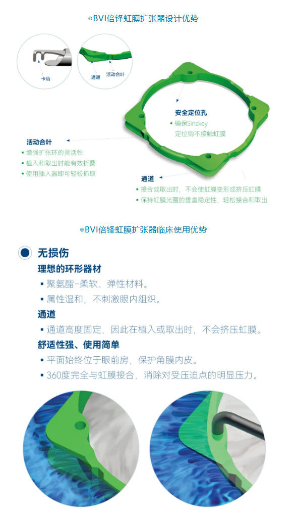 葡萄膜炎并发小瞳孔白内障的治疗