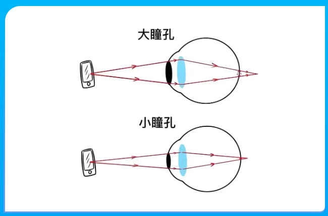 白内障医生的“神器”，小瞳孔“克星”