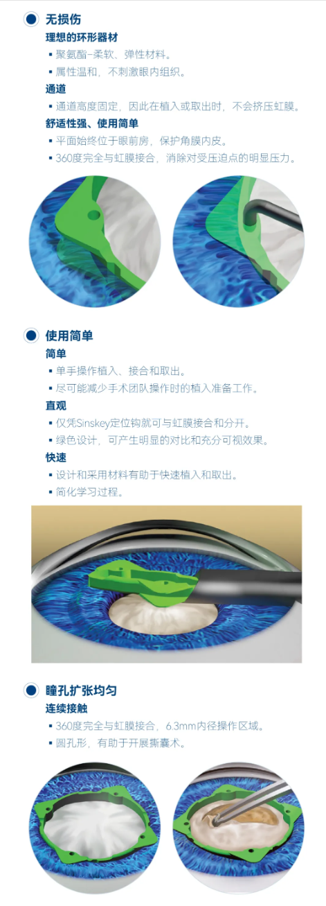 白内障医生的“神器”，小瞳孔“克星”