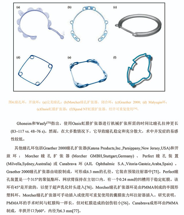 白内障手术中获得足够瞳孔大小的方法